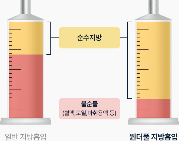 원더풀 바디 지방흡입 불순물 혈액 오일 마취용액 등 보다 높은 비율의 순수지방 추출