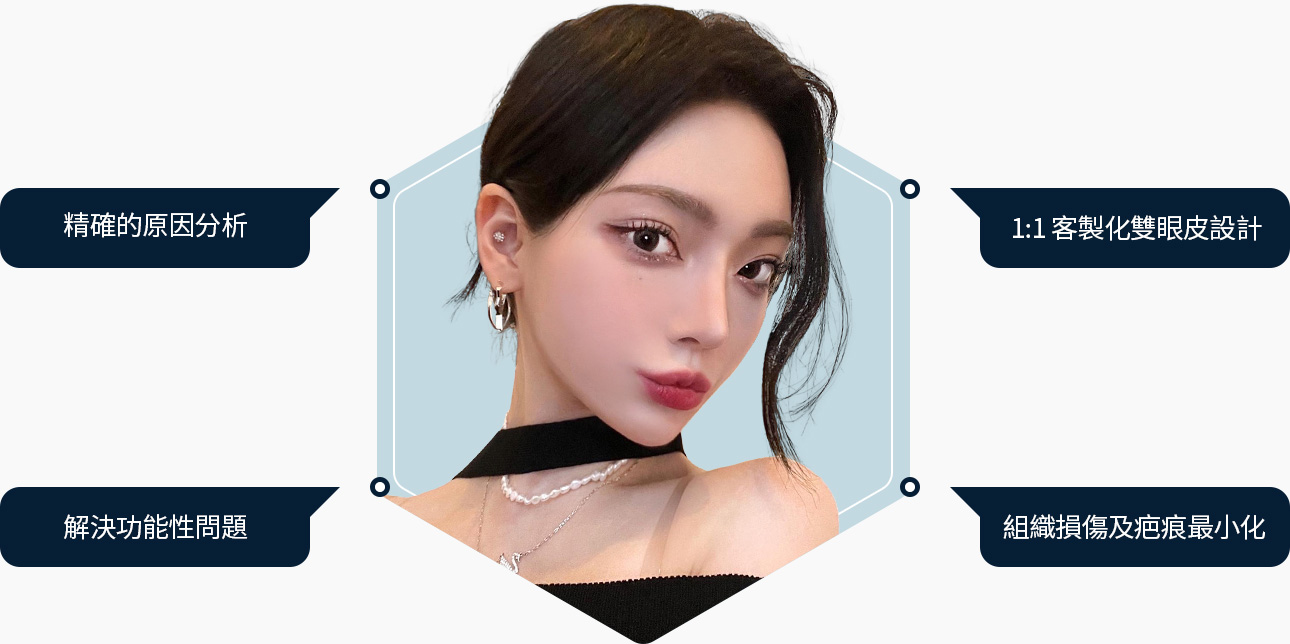 맞춤 쌍꺼풀 기능문제 해결 조직 흉터 최소화