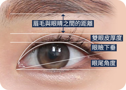 원더풀 완전절개 눈썹과 눈 사이 거리 쌍꺼풀 두께 안검하수 눈꼬리 각도