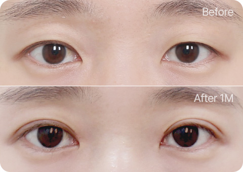 원더풀 자연유착 윗트임