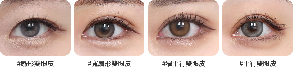Wonderful 部分切開 눈썹과 눈 사이 거리 쌍꺼풀 두께 안검하수 눈꼬리 각도