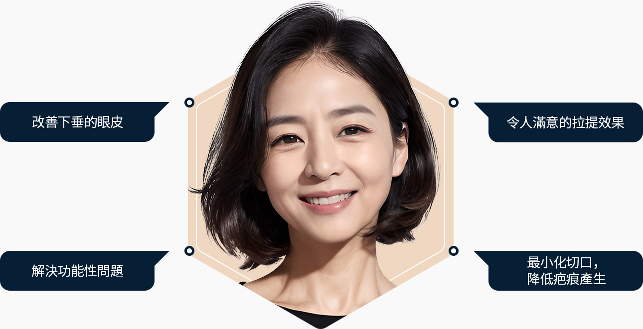 눈썹하거상술 처진 눈꺼풀정리 리프팅효과 기능문제해결 최소절개 흉터최소화