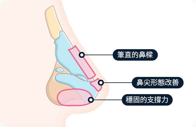 코라인 곧게 뻗은 콧대 코 끝 개선 튼튼한 지지대
