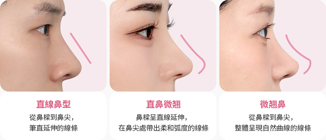 직선코라인 직반코라인 반버선코라인