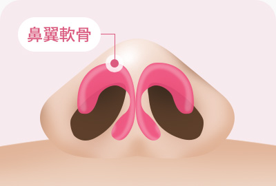 복코 성형 날개연골