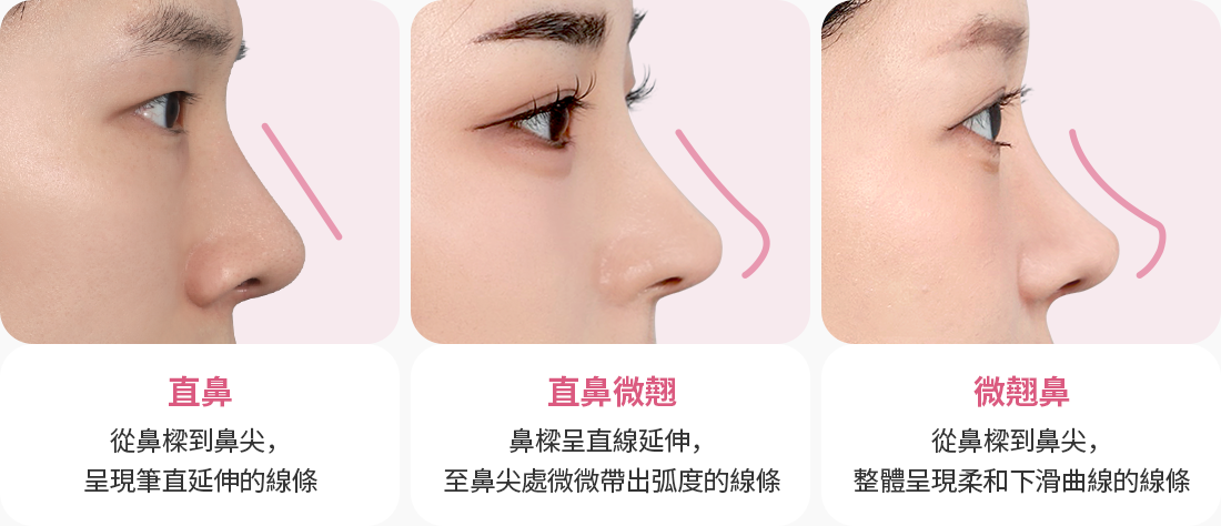 코성형 직선 코라인 직반 코라인 반버선 코라인