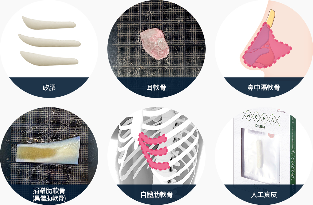 코성형 재료 실리콘 귀연골 비중격연골 기증늑연골 자가늑연골 인공진피