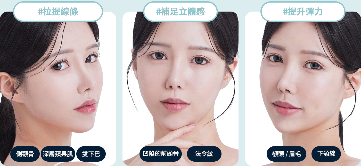 울쎄라 라인 맞춤 부위 옆광대 심부볼 이중턱 볼륨 맞춤 부위 앞광대 팔자주름 탄력 맞춤부위 이마 눈썹 턱라인 